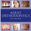 Adult Orthodontics 1st Edition