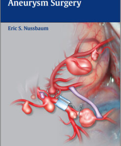 Video Atlas of Intracranial Aneurysm Surgery – Original PDF + Videos