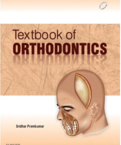 TEXTBOOK OF ORTHODONTICS