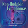 Non-Hodgkin Lymphomas Second Edition