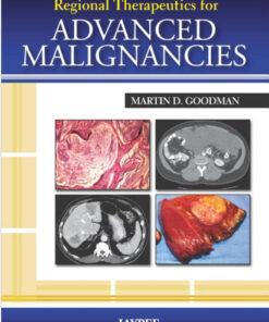 Regional Therapeutics for Advanced Malignancies 1st Edition