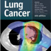 Lung Cancer 4th Edition