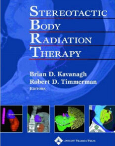 Stereotactic Body Radiation Therapy 1st Edition