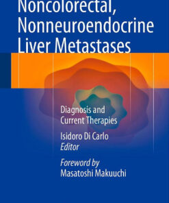 Noncolorectal, Nonneuroendocrine Liver Metastases: Diagnosis and Current Therapies 2015th Edition