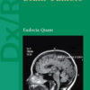 Dx/Rx : Brain Tumors