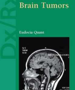 Dx/Rx : Brain Tumors