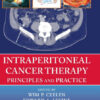 Intraperitoneal Cancer Therapy: Principles and Practice  Edition