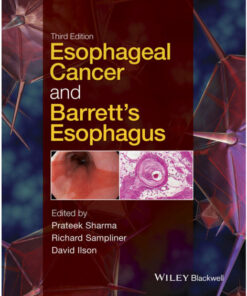 Esophageal Cancer and Barrett's Esophagus 3rd Edition