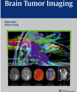 Brain Tumor Imaging 1st Edition