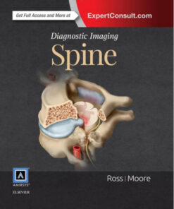 Diagnostic Imaging: Spine, 3e 3rd Edition PDF