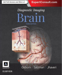 Diagnostic Imaging: Brain, 3e 3rd Edition