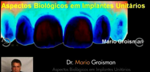 Aspectos Biologicos em Implantes Unitarios