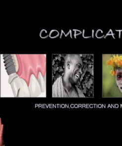 Implant Complications - Prevention, Correction and Maintenance