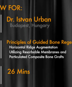 Principles of Guided Bone Regeneration - Horizontal Ridge Augmentation Utilizing Resorbable Membranes and Particulated Composite Bone Grafts