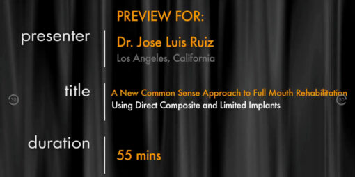 A New Common Sense Approach to Full Mouth Rehabilitation Using Direct Composite and Limited Implants