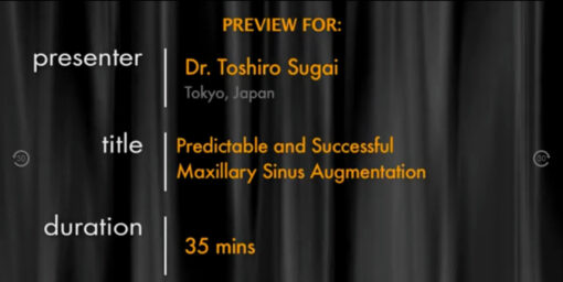 Predictable and Successful Maxillary Sinus Augmentation