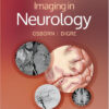 Imaging in Neurology