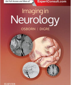 Imaging in Neurology