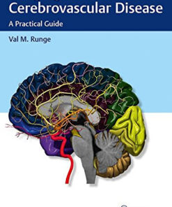 Imaging of Cerebrovascular Disease: A Practical Guide 1st Edition