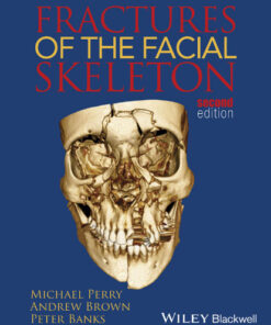 Fractures of the Facial Skeleton 2nd Edition