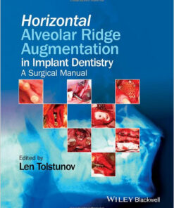 Horizontal Alveolar Ridge Augmentation in Implant Dentistry: A Surgical Manual 1st Edition