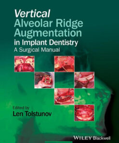 Vertical Alveolar Ridge Augmentation in Implant Dentistry: A Surgical Manual 1st Edition