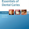 Essentials of Dental Caries 4th Edition