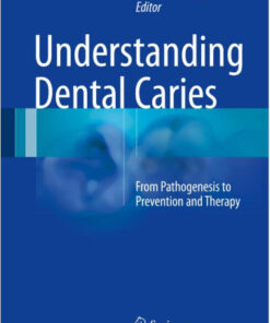 Understanding Dental Caries: From Pathogenesis to Prevention and Therapy 1st ed. 2016 Edition