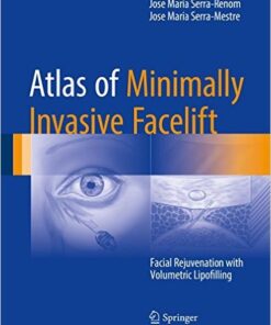 Atlas of Minimally Invasive Facelift: Facial Rejuvenation with Volumetric Lipofilling 1st ed. 2016 Edition