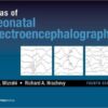 Atlas of Neonatal Electroencephalography, Fourth Edition 4th Edition