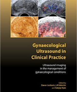 Gynaecological Ultrasound in Clinical Practice: Ultrasound Imaging in the Management of Gynaecological Conditions 1st Edition