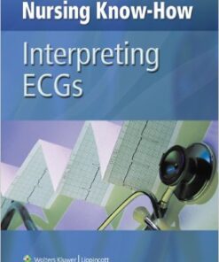 Nursing Know-How: Interpreting ECGs Kindle Edition