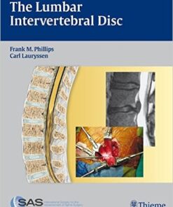 The Lumbar Intervertebral Disc 1st Edition