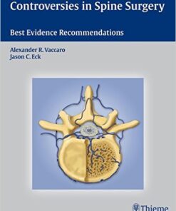 Controversies in Spine Surgery: Best Evidence Recommendations 1st Edition