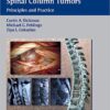 Spinal Cord and Spinal Column Tumors: Principles and Practice 1st Edition