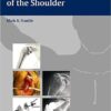 Rotator Cuff Deficiency of the Shoulder 1st Edition