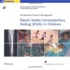 Elastic Stable Intramedullary Nailing (ESIN) in Children