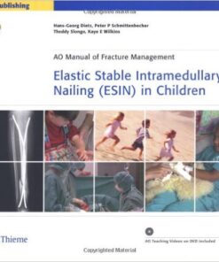 Elastic Stable Intramedullary Nailing (ESIN) in Children