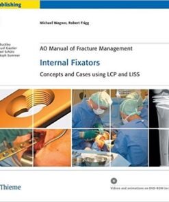 AO Manual of Fracture Management: Internal Fixators: Concepts and Cases using LCP/LISS 1st Edition