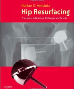 Hip Resurfacing: Principles, Indications, Technique and Results 1e