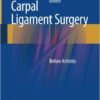 Carpal Ligament Surgery: Before Arthritis