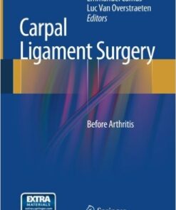 Carpal Ligament Surgery: Before Arthritis