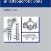 Internal Fixation in Osteoporotic Bone 1st Edition