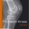 The Problem Knee: Diagnosis and Management in the Younger Patient