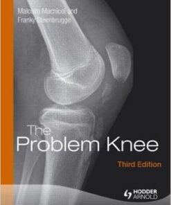 The Problem Knee: Diagnosis and Management in the Younger Patient