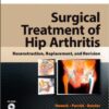 Surgical Treatment of Hip Arthritis: Reconstruction, Replacement, and Revision 1e