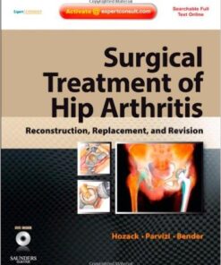 Surgical Treatment of Hip Arthritis: Reconstruction, Replacement, and Revision 1e