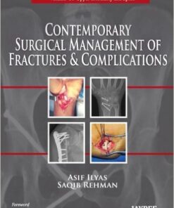 Contemporary Surgical Management of Fractures and Complications 1st Edition