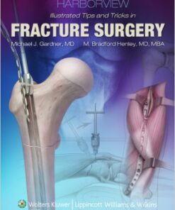 Harborview Illustrated Tips and Tricks in Fracture Surgery 1st Edition