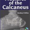 Fractures of the Calcaneus 1 Har/Dvdr Edition